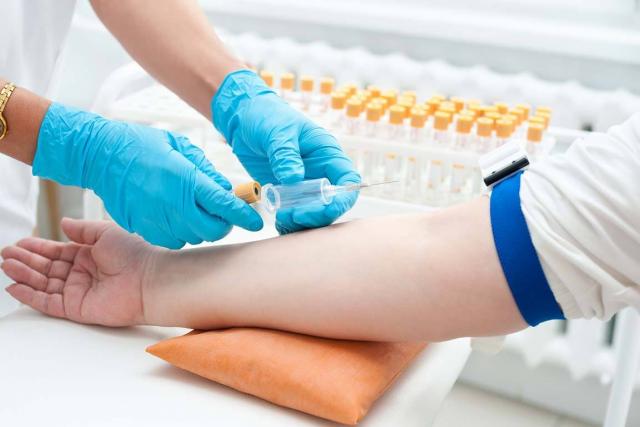 Što je krvni test za hCG, kako se pripremiti i zašto uzeti test tijekom trudnoće