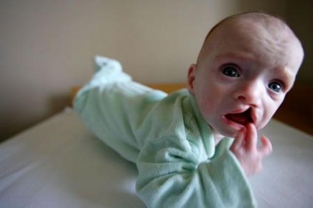 Karmički uzroci bolesti: zašto se rađaju bolesna djeca?